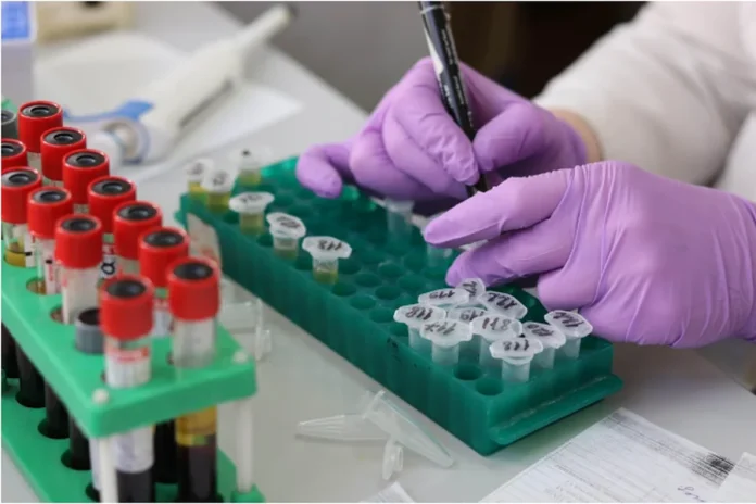 How Same-Day Blood Test Results Are Changing the Way People Manage Their Health Their Health