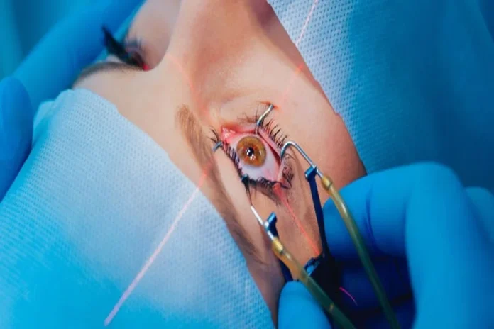 LASIK Eye Surgery for High Power Vision Problems LASIK Eye Surgery for High Power Vision Problems