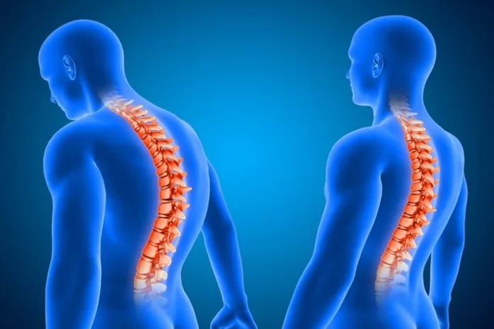 Living with a Slipped Disc