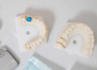 Dental Crown Singapore Options: Porcelain, Zirconia, and Metal Explained