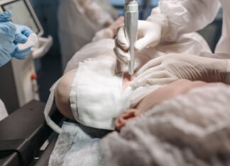 How Skin Analysis Helps A Top Pigmentation Clinic Singapore Plan Your Treatment pigmentation clinic singapore